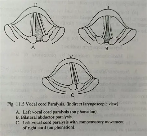 Vibrate Whether or Not the Vocal Cords